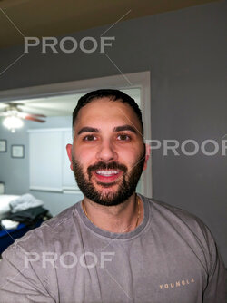 shadow removal V2.jpg