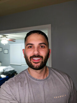 shadow removal V2 FINAL.jpg