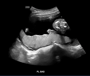 yfsu7sdszooc1.png yfsu7sdszooc1.png