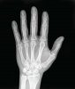 01_16_X-ray_of_Hand.jpg