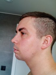 Overbite.jpg Overbite.jpg